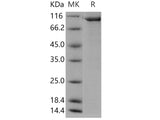 Recombinant Human PFK1/PFKM Protein (His & GST Tag)