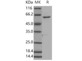 Recombinant Human ROR1 Protein (aa 453-783, His & GST Tag)(Active)