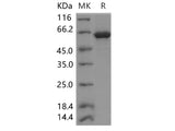 Recombinant Human EphA2 Protein (aa 585-976, His & GST Tag)(Active)