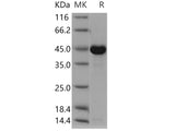 Recombinant Human CKMT1A Protein (His Tag)