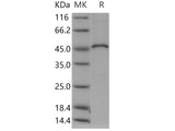 Recombinant Human MVK/Mevalonate kinase Protein (His & GST Tag)