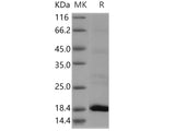 Recombinant Human Flavokinase/RFK Protein (His Tag)