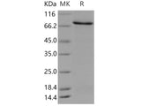 Recombinant Human PFK2/PFKFB3 Protein (His & GST Tag)