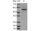 Recombinant Human STK24/MST3 Protein (His Tag)(Active)