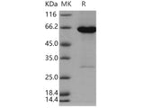 Recombinant Human ADK Protein (His & GST Tag)