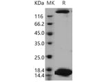 Recombinant Human SPEG/APEG-1 Protein (His Tag)