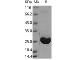 Recombinant Human AK1/Adenylate kinase 1 Protein (His Tag)