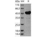 Recombinant Human AK4/AK3L1 Protein (His & GST Tag)