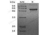 Recombinant Human CSNK1G2 Protein (His Tag)(Active)