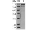 Recombinant Human FES Kinase/Feline sarcoma oncogene Protein (His & GST Tag)(Active)