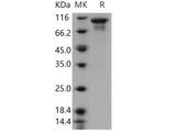 Recombinant Human STK16/PKL12/MPSK Protein (His & NusA Tag)