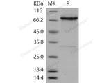 Recombinant Human RET Kinase Protein (aa 658-1114, His & GST Tag)(Active)