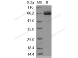 Recombinant Human EphB1/EPHT2 Protein (aa 565-984, His & GST Tag)(Active)