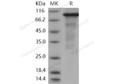 Recombinant Human ERN1/IRE1 Protein (aa 465-977, His & GST Tag)(Active)