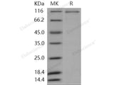 Recombinant Human MAP4K2/GC Kinase Protein (His & GST Tag)