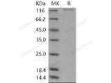 Recombinant Human MAP4K5/MEKKK5 Protein (His & GST Tag)