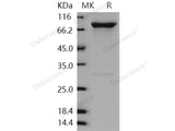 Recombinant Human GRK6/GPRK6 Protein (His & GST Tag)(Active)