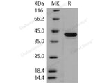 Recombinant Human STK10/LOK Protein (His Tag)(Active)