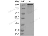 Recombinant Human PRKD2/PKD2 Protein (His & GST Tag)(Active)