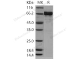 Recombinant Human EphA7/EHK3 Protein (His & GST Tag)(Active)