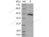 Recombinant Human IDO1/IDO Protein (Gly&Ala2-Gly403)(Active)