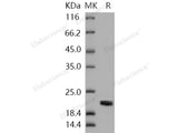 Recombinant Human NME1/NDKA Protein (His Tag)