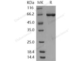 Recombinant Human STK40 Protein (His & GST Tag)