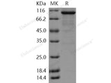 Recombinant Human DCAMKL1 Protein (aa 1-705, His & GST Tag)(Active)