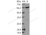 Recombinant Human NLK Protein (His & GST Tag)(Active)