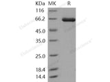 Recombinant Human TLK2/PKU-ALPHA Protein (His&GST Tag)