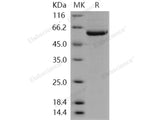 Recombinant Human STK4/MST1 Protein (His Tag)(Active)