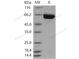 Recombinant Human PAK3 Protein (His Tag)(Active)