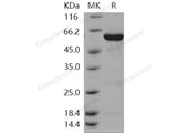 Recombinant Human GALK1/Galactokinase Protein (His & GST Tag)