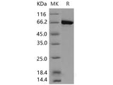 Recombinant Human EphA4 Protein (aa 570-986, His &GST Tag)(Active)