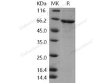 Recombinant Human CDKL2 Protein (His Tag)