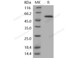 Recombinant Human Glucokinase/GCK Protein