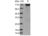 Recombinant Human Hexokinase-3/HK3 Protein (His & GST Tag)