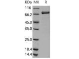 Recombinant Human Lyn Kinase Protein (GST Tag)(Active)