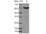 Recombinant Human FGFR2/CD332 Protein (aa 400-821, His & GST Tag)(Active)