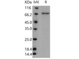 Recombinant Human TPL2/MAP3K8/MEKK8 Protein (GST Tag)