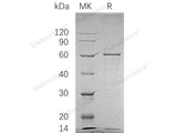 Recombinant Human BLK Protein (GST Tag)(Active)