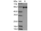 Recombinant Human EphB2 Protein (aa 570-987, His &GST Tag)(Active)