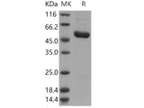 Recombinant Human IRAK4/IRAK-4 Protein (His Tag)(Active)