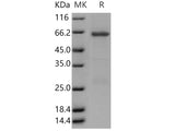 Recombinant Human TRIB3/TRB3 Protein (GST Tag)