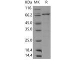 Recombinant Human DDR1 Kinase/MCK10 Protein (aa 444-913, His & GST Tag)(Active)