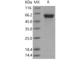 Recombinant Human CAMK1D Protein (GST Tag)(Active)