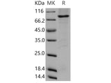 Recombinant Human DYRK3/REDK Protein (His & GST Tag)(Active)