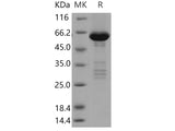 Recombinant Human TRIB2/TRB2 Protein (His & GST Tag)