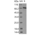 Recombinant Human c-MET/HGFR Protein (aa 956-1390, His & GST Tag)(Active)