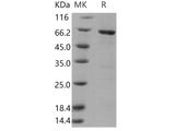 Recombinant Human MAPKAPK3 Protein (GST Tag)